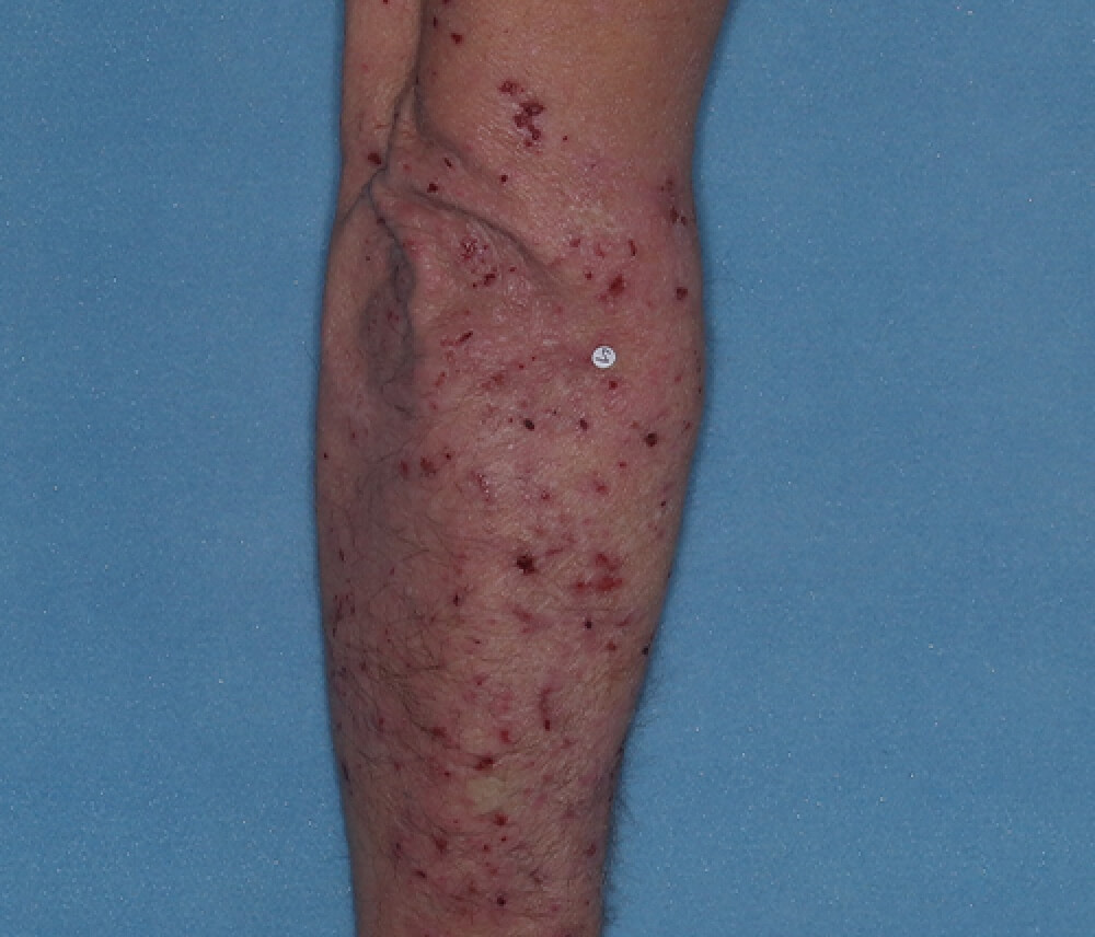 Patient left arm before and after.