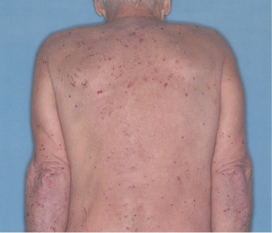 Back before the treatment.