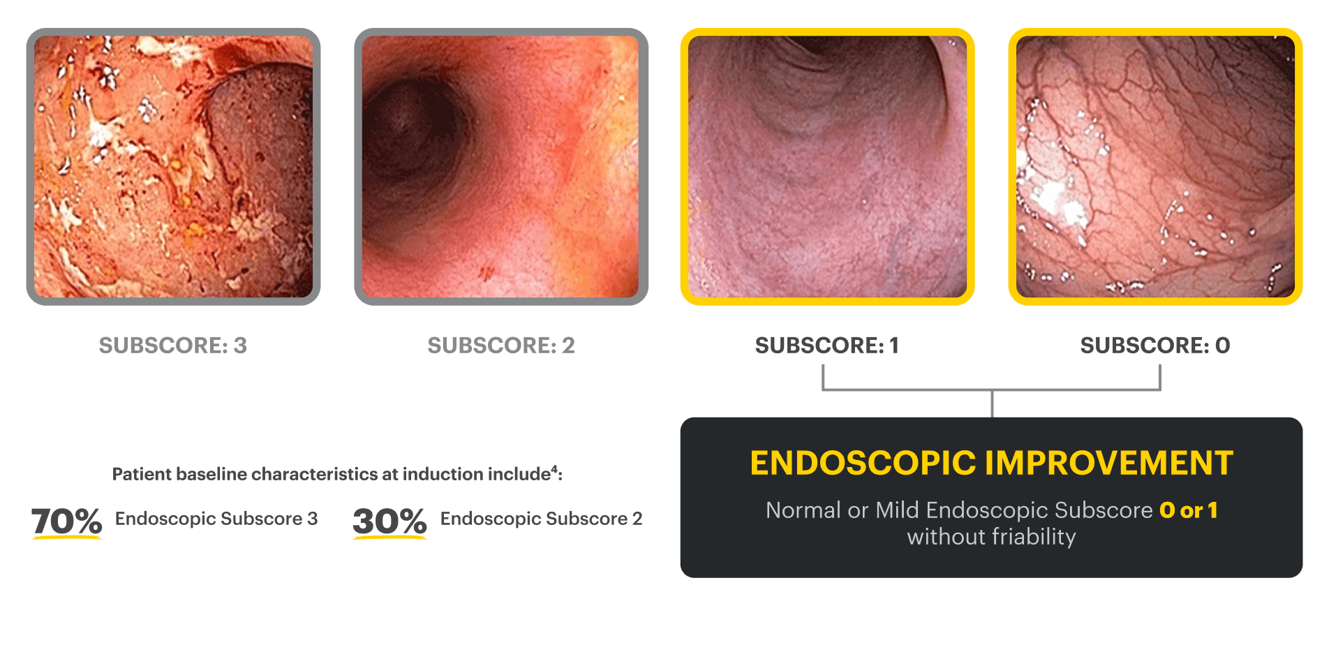 Four endoscopic images show changes in mucosal appearance, ranging from Mayo endoscopy subscore of 0, which is normal; 1, which is mild; 2, which is moderate; and 3, which is severe.   The baseline characteristics are noted as 70% of patients who began the clinical trial had an endoscopic subscore of 3, and 30% had an endoscopic subscore of 2. Endoscopic improvement is defined as a Mayo endoscopy subscore of 0 or 1, without friability.